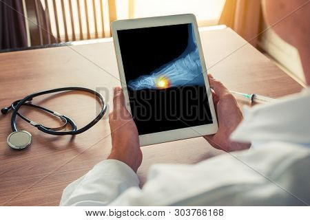 Doctor Holding A Digital Tablet With X-ray. Pain Under The Foot. Stethoscope And Syringe In The Desk