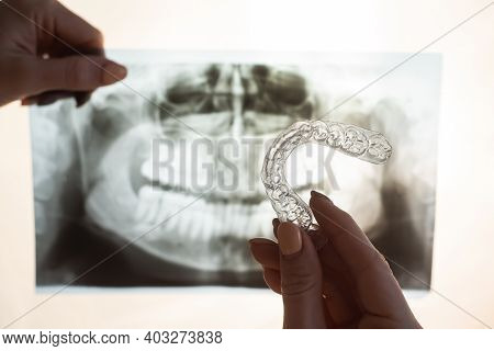 Female Hands With Transparent Mouth Guards For Correcting Bite And X-ray Of The Jaw. The Orthodontis