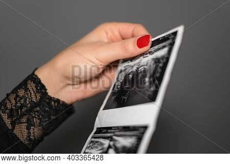 Woman Checking Ecography Diagnostic Exams Result, Pregnancy Anxiety, Health Care
