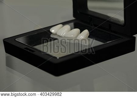 Ceramic Veneers For A Beautiful Smile
Ceramic Veneers For A Beautiful Smile