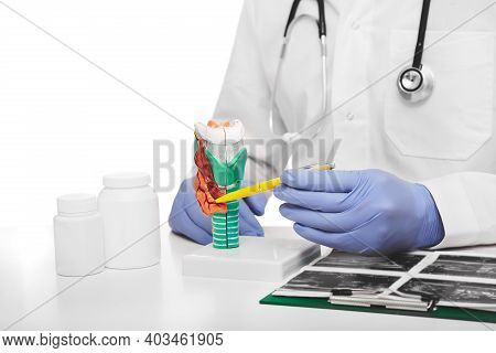Diagnostics And Treatment Of Autoimmune Thyroid Diseases. Doctor Pointing Anatomy Of Thyroid Gland. 