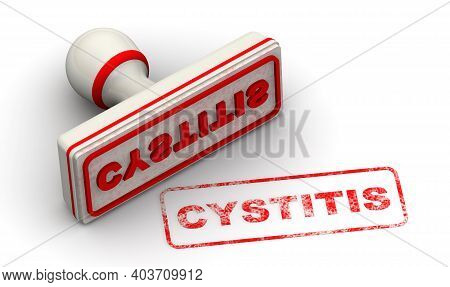 Cystitis. The Stamp And An Imprint. White Stamp And Red Imprint Cystitis (is Inflammation Of The Bla