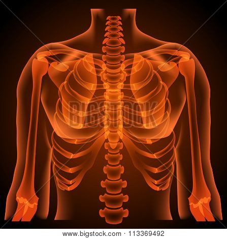 surgeon radiologist medical examaning lung torso  x-ray