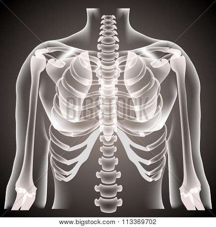 surgeon radiologist medical examaning lung torso  x-ray