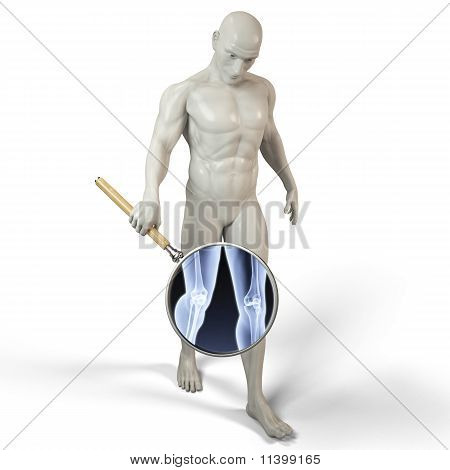 Lupa X-ray