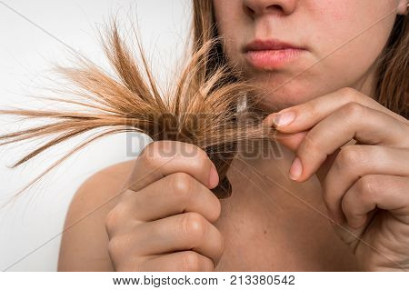 Hair Problems - Brittle, Damaged, Dry And Loss Hair Concept