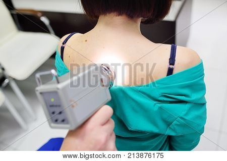 The doctor examines neoplasms or moles on the patient's skin - a young girl using a special apparatus for dermatoscopy - a dermoscope. Prevention of melanoma and skin cancer.