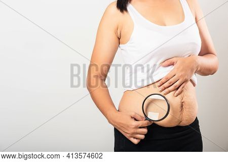 Close Up Of Asian Mother Woman Use Magnifying Glass Show Stretch Mark Loose Lower Abdomen Skin She F