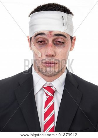 Man With Bruised Eyes And Head, Funny Businessman