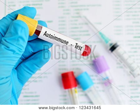 Test tube with blood sample for autoimmune disease test
