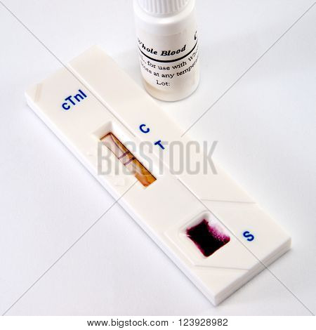 Test troponin on heart attack of the myocardium for diagnostics in laboratory