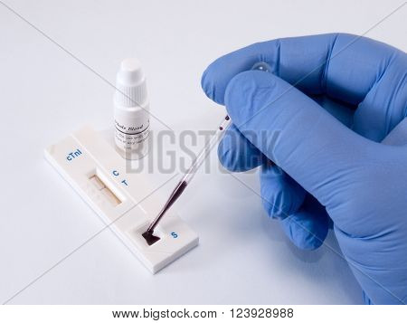 Test troponin on heart attack of the myocardium for diagnostics in laboratory