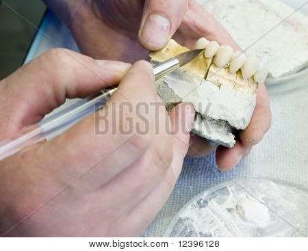 fabbricazione di protesi protesi