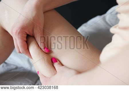 Woman Holding With Her Hands Skin Fold With Cellulite On Her Thigh Closeup