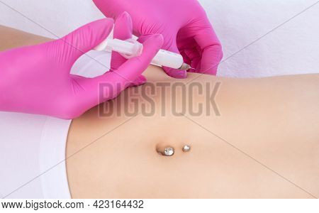 A Doctor Of Aesthetic Cosmetology Makes Lipolytic Injections To Burn Body Fat On A Woman’s Stomach A