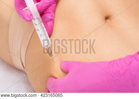A Doctor Of Aesthetic Cosmetology Makes Lipolytic Injections To Burn Body Fat On A Woman’s Stomach A