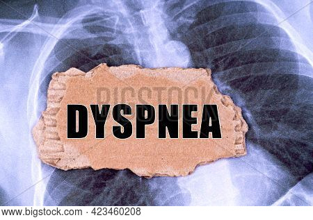 Medicine Concept. On The X-ray There Is A Piece Of Cardboard With The Inscription - Dyspnea