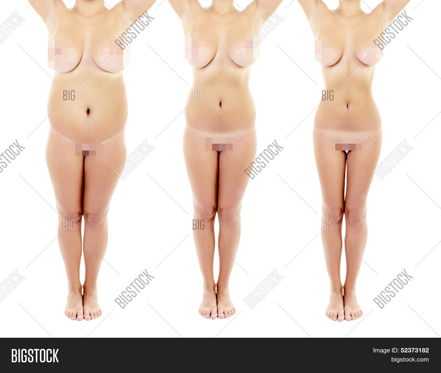 Download high-quality Shots before after loss weight overweight woman image...