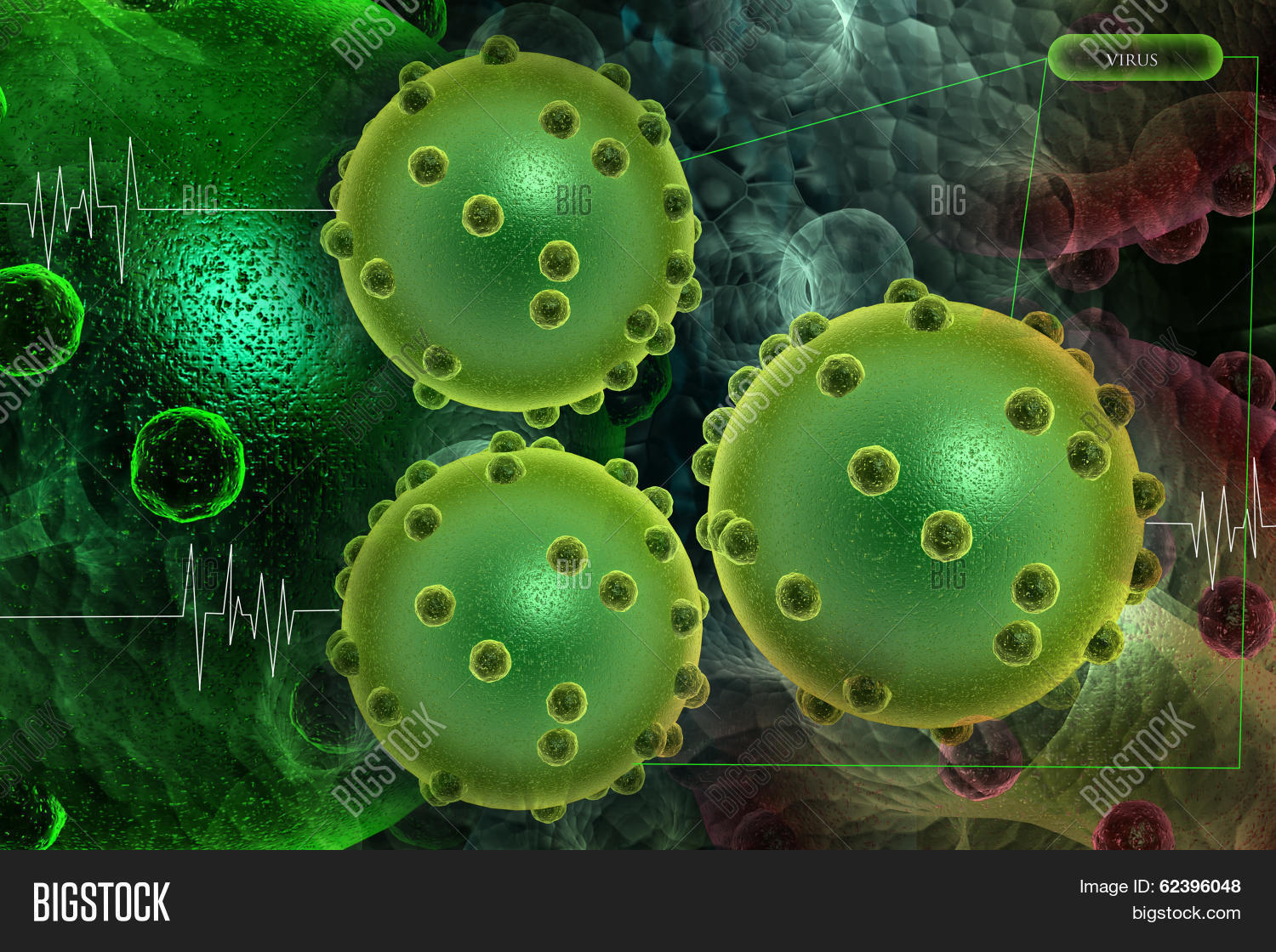 вирусный менингит строение. гиалиновые мембраны в альвеолах. менингеальная инфекция патогенез. т вирус. вирусная жидкость.