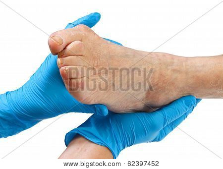 Elderly Feet