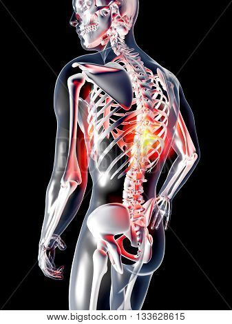 Anatomy - Back Pain.