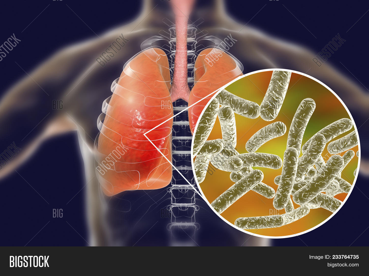 Legionella Pneumophila Image & Photo (Free Trial) | Bigstock