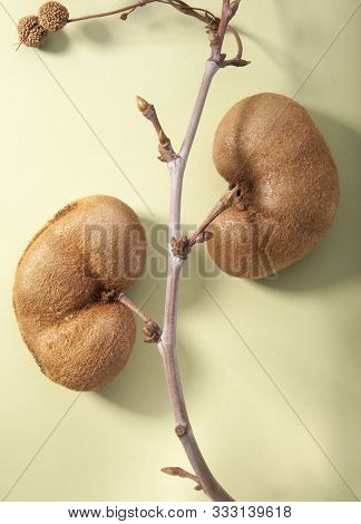 Kiwi Fruits, Similar To The Kidneys. Kidney Health Concept. Promotional Photo Concept Of Kidney Dise