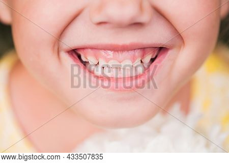 Smile Of A Little Caucasian Girl With Baby Theeth.
