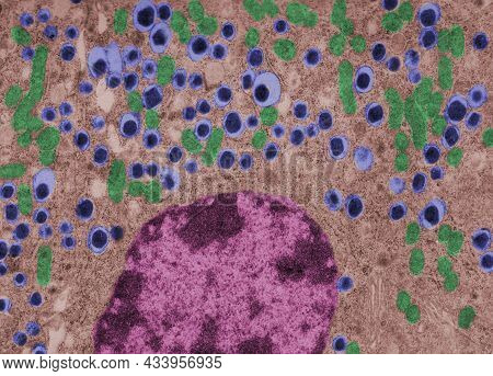 False Colour Transmission Electron Microscope (tem) Micrograph Of A Beta Cell Of A Islet Of Langerha