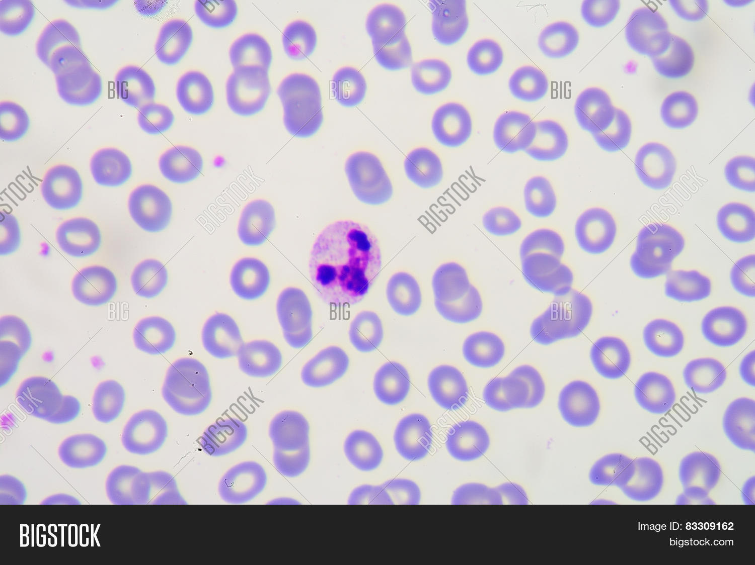 Toxic Granulations Image & Photo (Free Trial) Bigstock