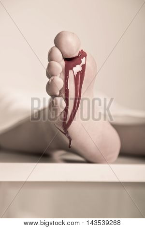 Bloodied Foot Of An Accident Victim In A Mortuary