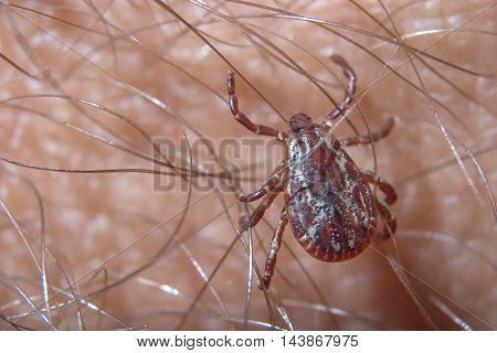 The American Dog Tick On My Arm Female Dermacentor variabilis