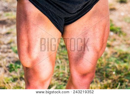 Young Bodybuilder Showing Shaped Quadriceps Muscles Outdoors