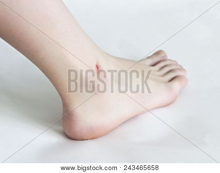 Female Leg On White Background, Cut After Shaving Legs
