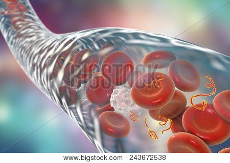 Ebola Viruses In Blood Of A Patient With Ebola Hemorrhagic Fever, 3d Illustration. Viruses Are Seen 
