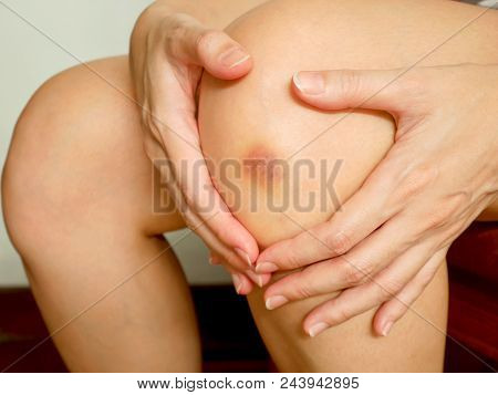 Woman's Got A Purple Bruise