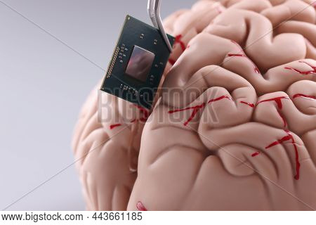 Close-up Of Someone Put Tiny Computer Chip Detail In Human Brain With Tweezer. Microprocessor In Hea