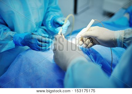 hand surgeon makes an operation closeup. surgical instruments