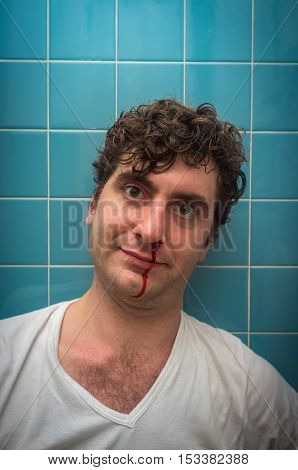 Curly haired man in bathroom with bad nose bleed