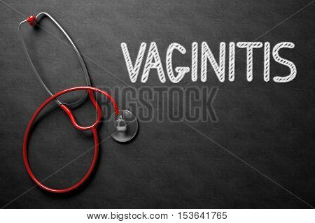 Medical Concept: Black Chalkboard with Handwritten Medical Concept - Vaginitis with Red Stethoscope. Top View. Medical Concept: Vaginitis - Text on Black Chalkboard with Red Stethoscope. 3D Rendering.