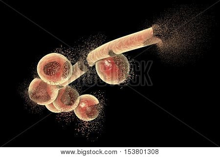 Destruction of Candida fungi, 3D illustration. Can be used to illustrate effect of antifungal drugs, medicines, microbes, nanoparticles