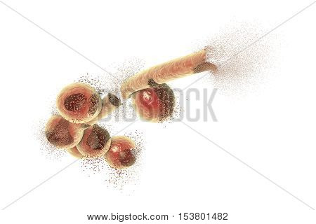 Destruction of Candida fungi, 3D illustration. Can be used to illustrate effect of antifungal drugs, medicines, microbes, nanoparticles