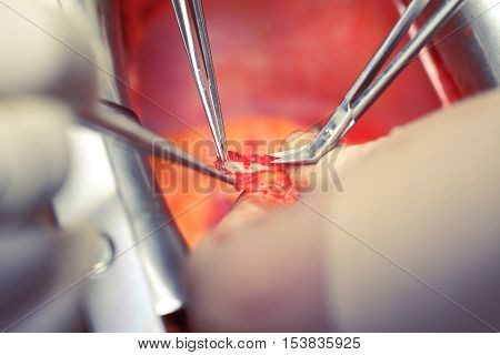 Surgery. Working with the patient's tissues. Microsurgical technique.