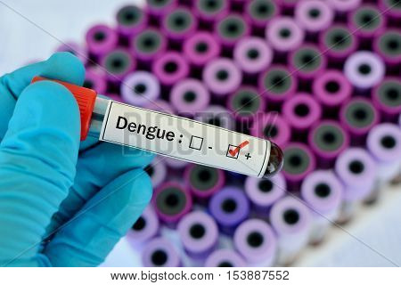 Test tube with blood sample positive with dengue virus