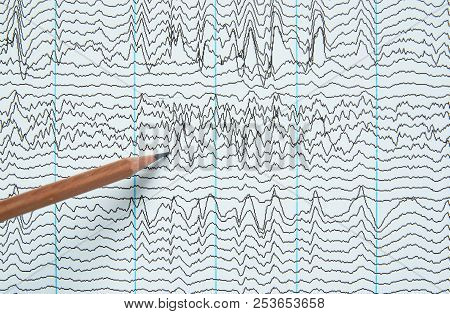 Pencil Pointing At Brain Waves From Electroencephalography Or Eeg In Human