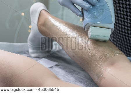 Depilation Spa Procedure. Woman Hair Remove Waxing. Epilation Sugaring. Legs Foot With Wax Melter. H