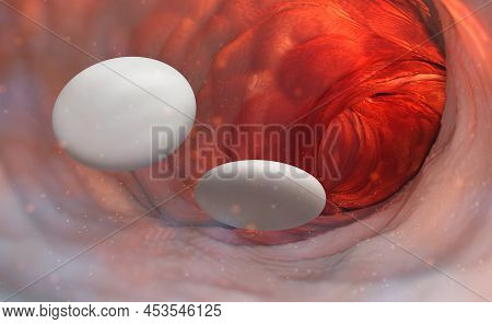 Heartburn Pills. Relieving Irritation And Inflammation. Help With Sore Throat. Painkillers Pills In 