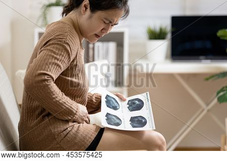 Hand Of Woman Holding Transabdominal Ultrasound Image,medical Examination,female Has Stomach Ache,se