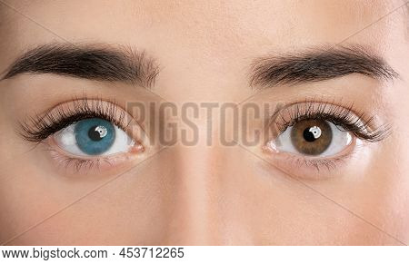 Woman With Different Colors Of Eyes, Closeup. Heterochromia Iridis
