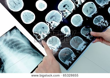 Doctor Holding Tomography And Points Into An Area On It